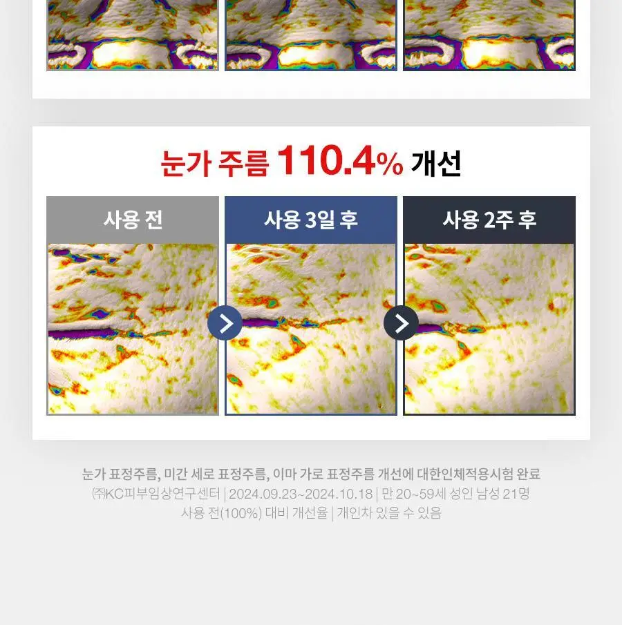 [리뉴얼/펩타이드/속보습] 닥터지 레드 블레미쉬 포 맨 탄력 올인원 2종 택 1 (단품/증정 기획) 상세페이지 19